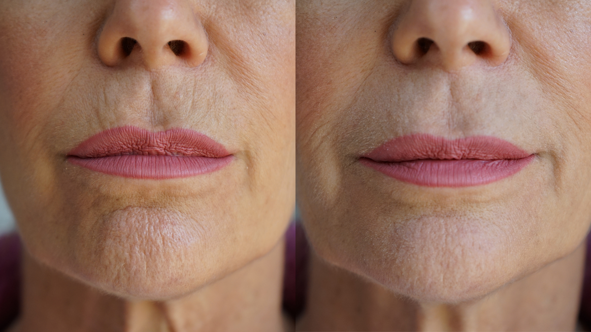 Ageless Lip & Line Filler - Lilixa.store