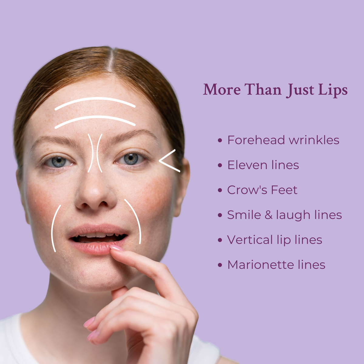 Ageless Lip & Line Filler - Lilixa.store